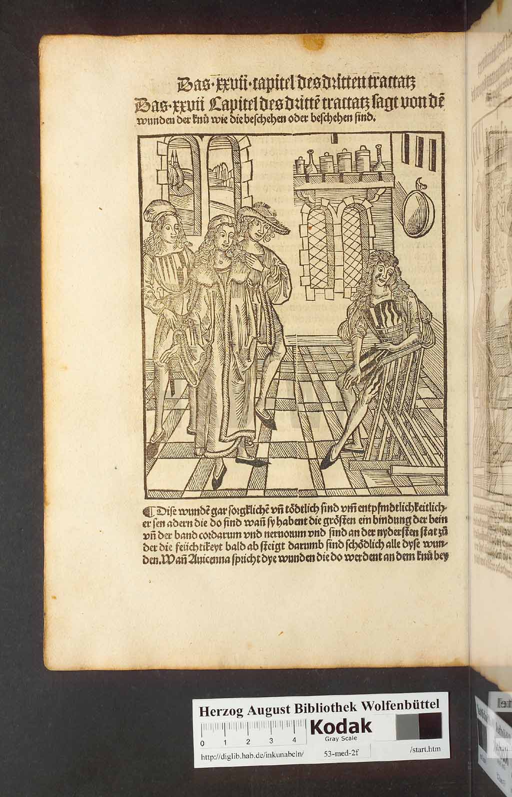 http://diglib.hab.de/inkunabeln/53-med-2f/00170.jpg