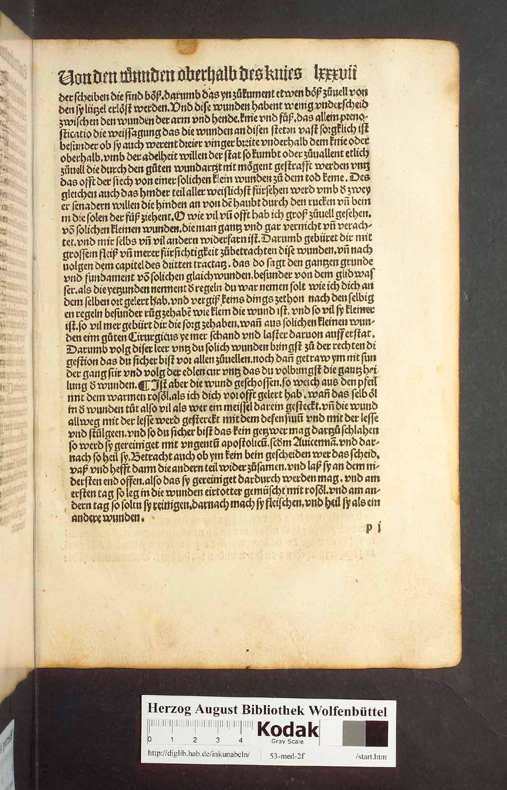 http://diglib.hab.de/inkunabeln/53-med-2f/00171.jpg