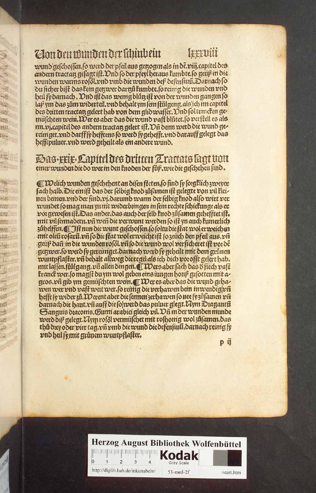 http://diglib.hab.de/inkunabeln/53-med-2f/00173.jpg
