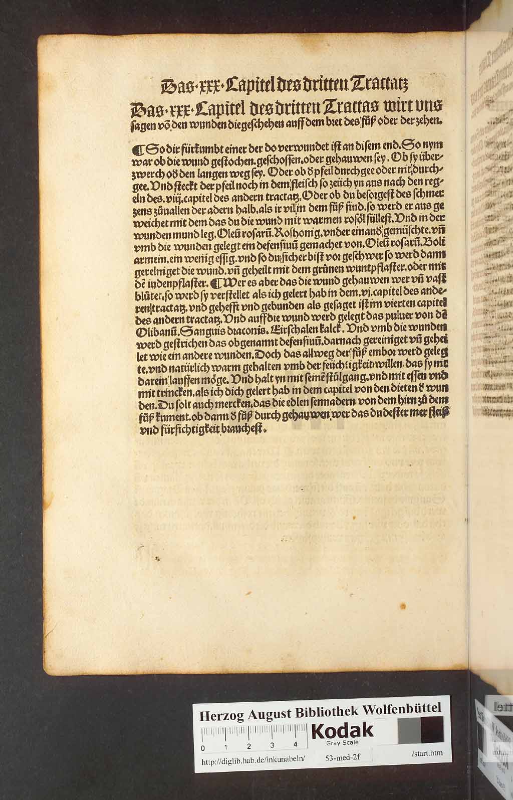 http://diglib.hab.de/inkunabeln/53-med-2f/00174.jpg