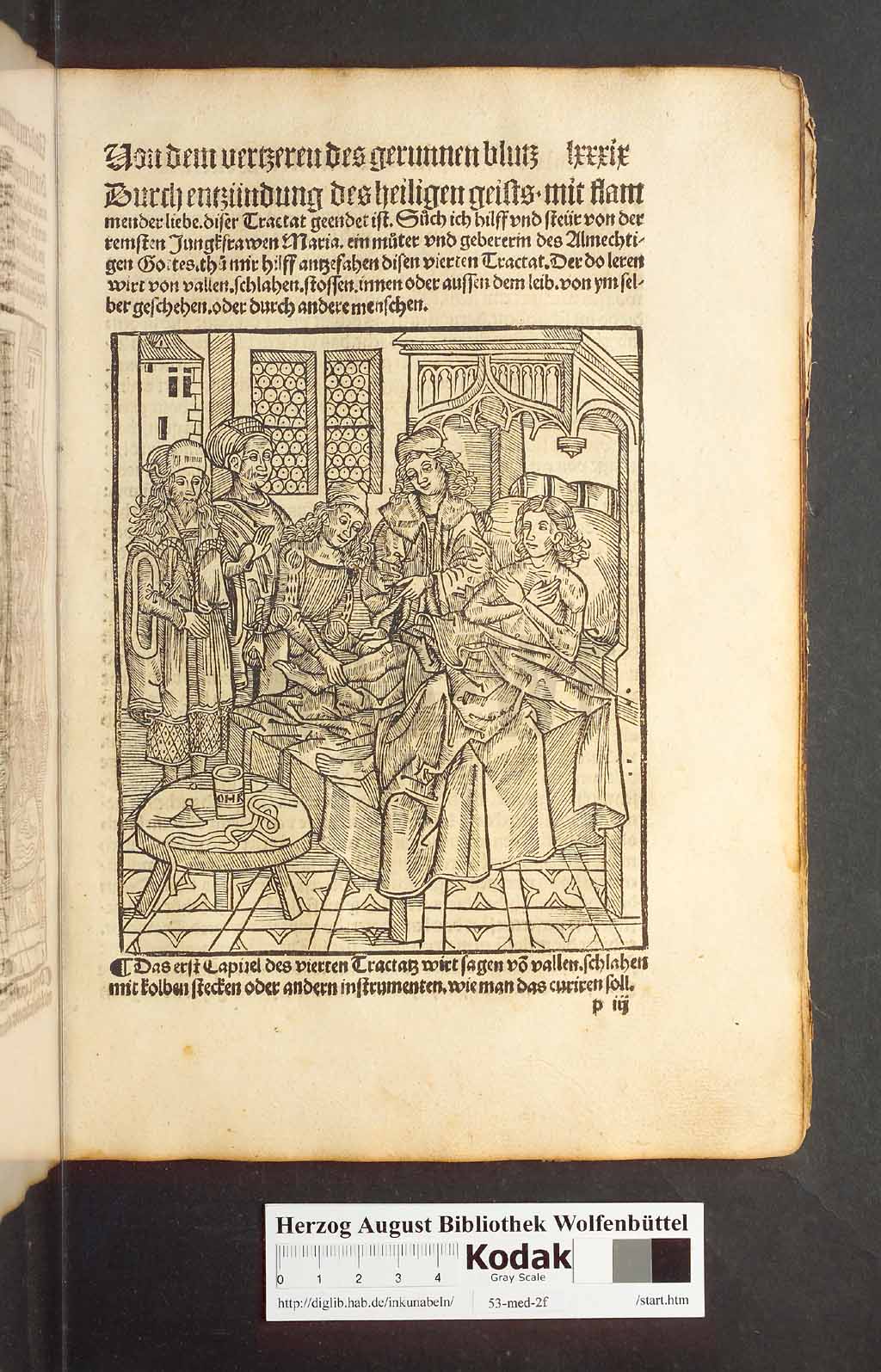 http://diglib.hab.de/inkunabeln/53-med-2f/00175.jpg