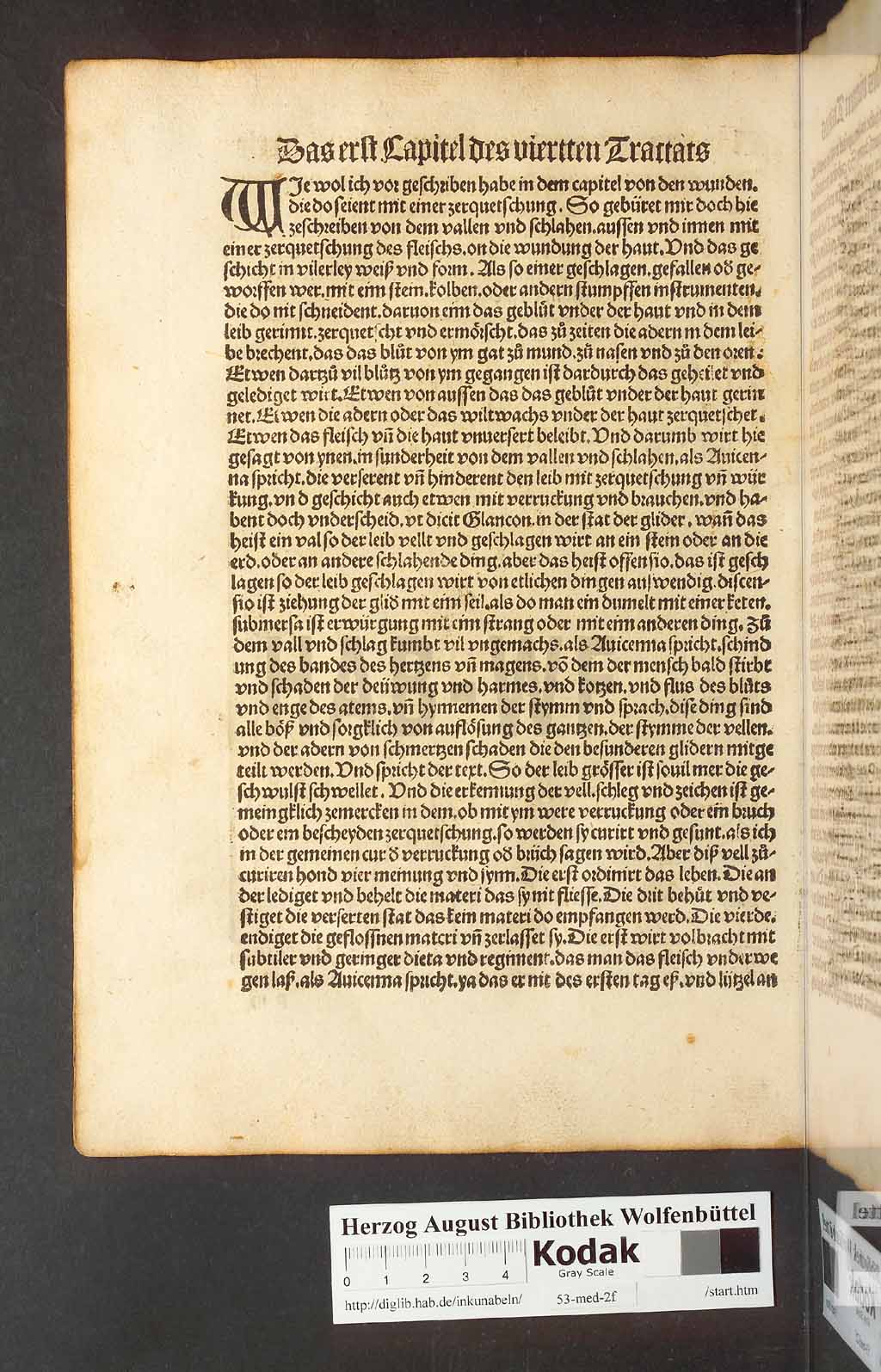 http://diglib.hab.de/inkunabeln/53-med-2f/00176.jpg