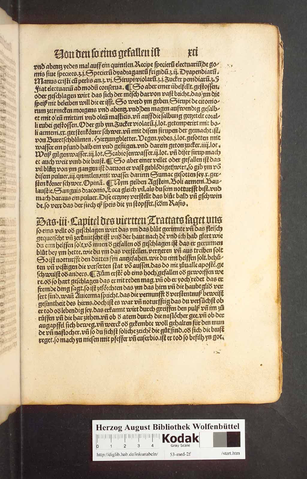 http://diglib.hab.de/inkunabeln/53-med-2f/00179.jpg