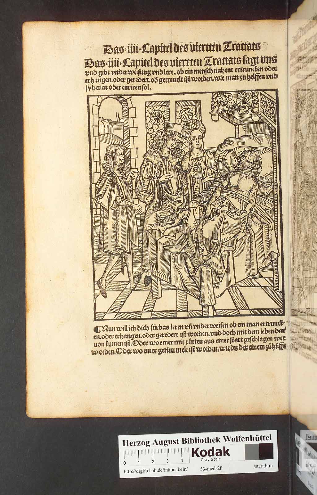 http://diglib.hab.de/inkunabeln/53-med-2f/00182.jpg