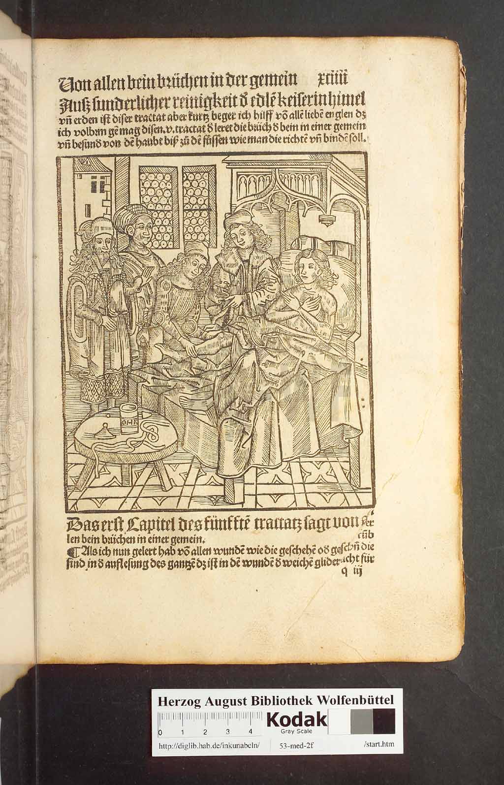 http://diglib.hab.de/inkunabeln/53-med-2f/00185.jpg