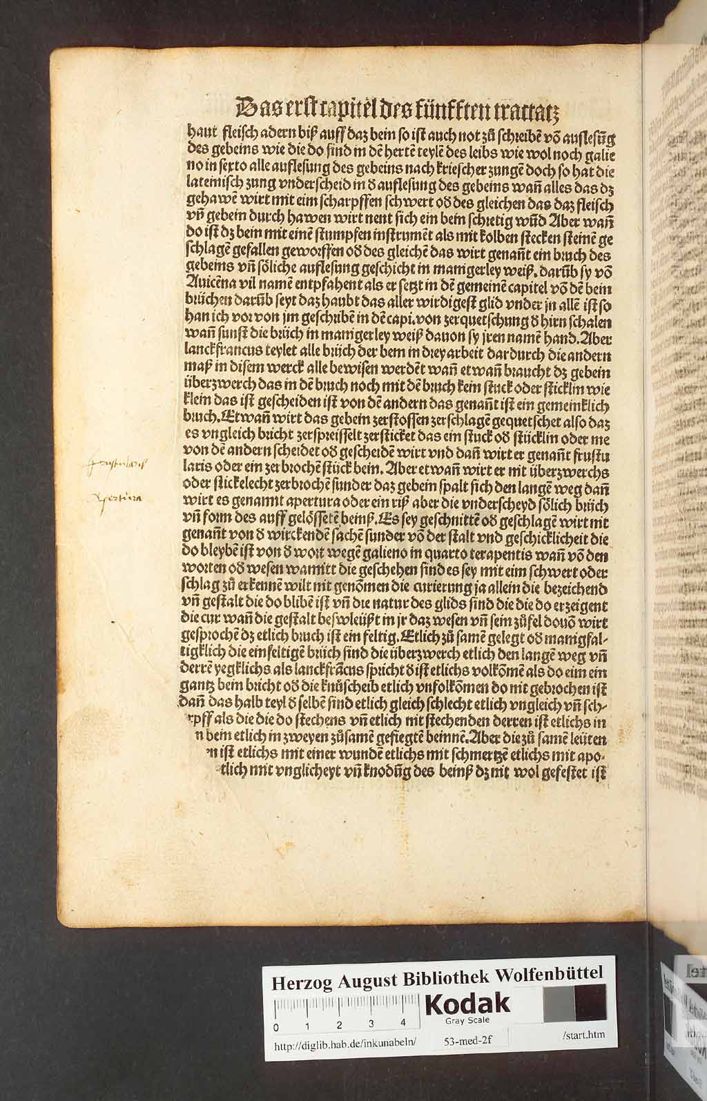 http://diglib.hab.de/inkunabeln/53-med-2f/00186.jpg