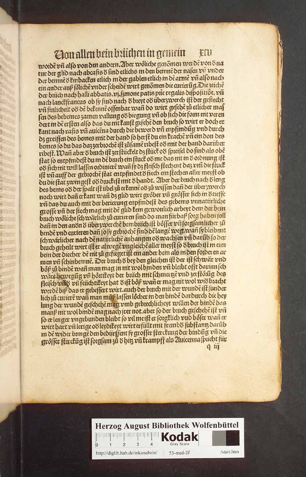 http://diglib.hab.de/inkunabeln/53-med-2f/00187.jpg