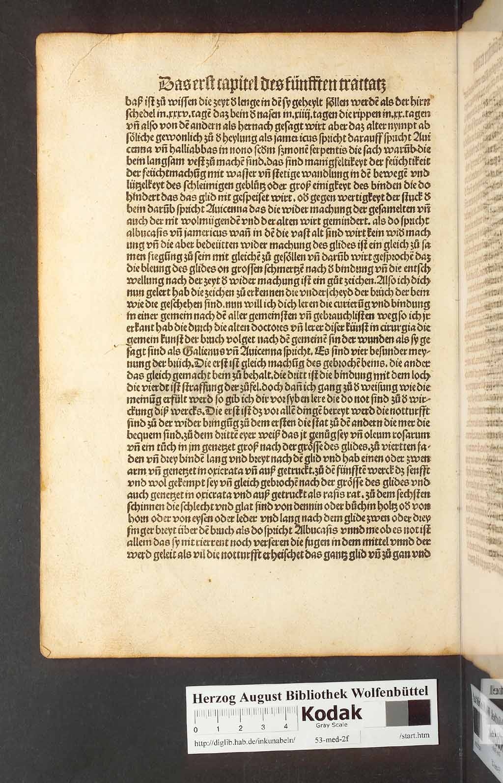 http://diglib.hab.de/inkunabeln/53-med-2f/00188.jpg