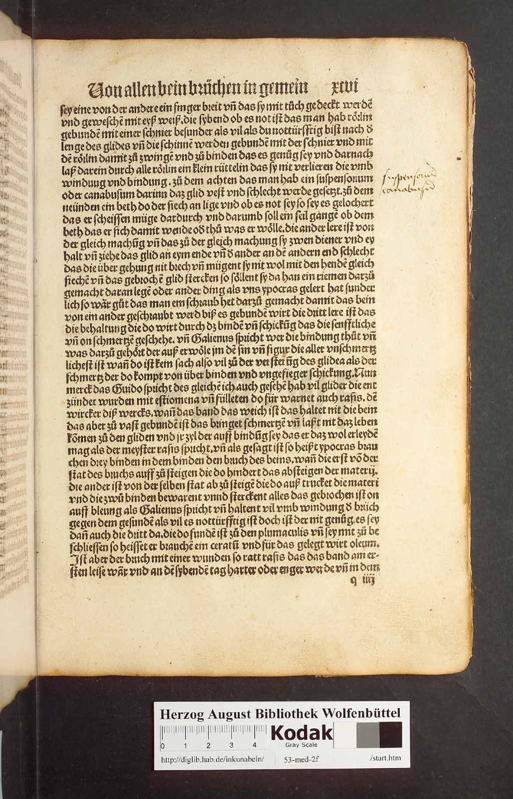 http://diglib.hab.de/inkunabeln/53-med-2f/00189.jpg