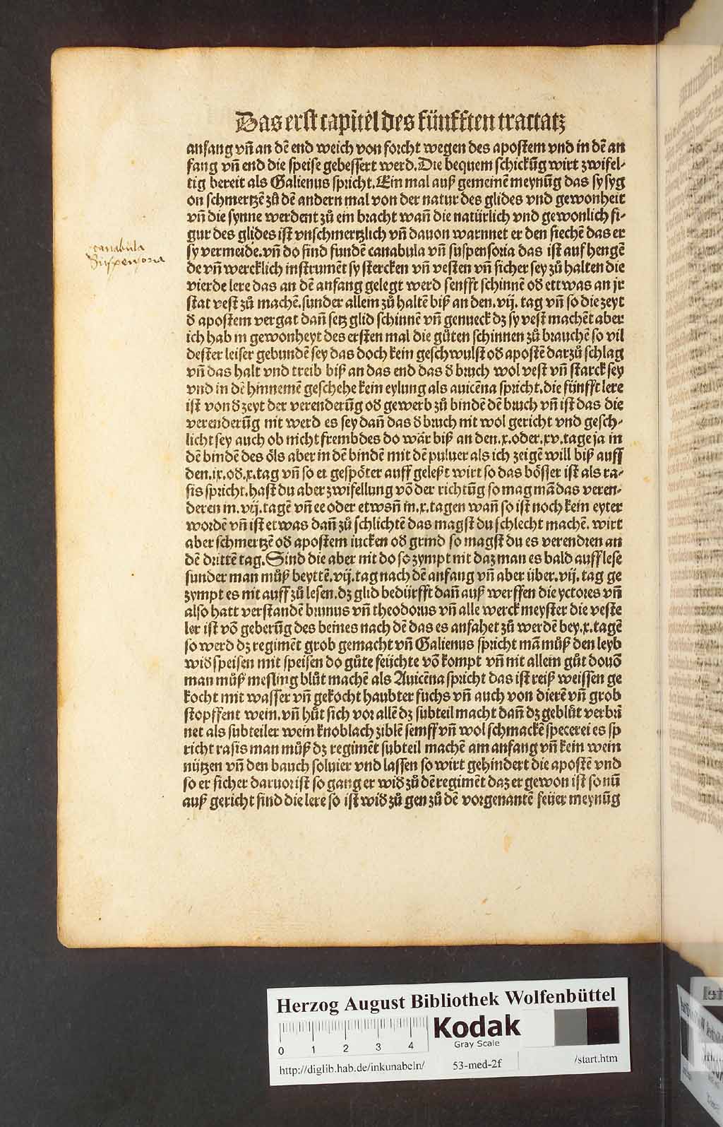 http://diglib.hab.de/inkunabeln/53-med-2f/00190.jpg