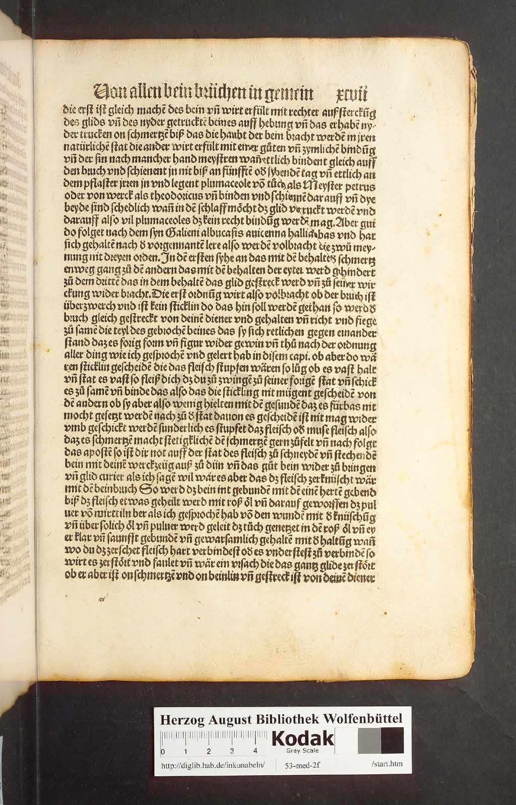 http://diglib.hab.de/inkunabeln/53-med-2f/00191.jpg