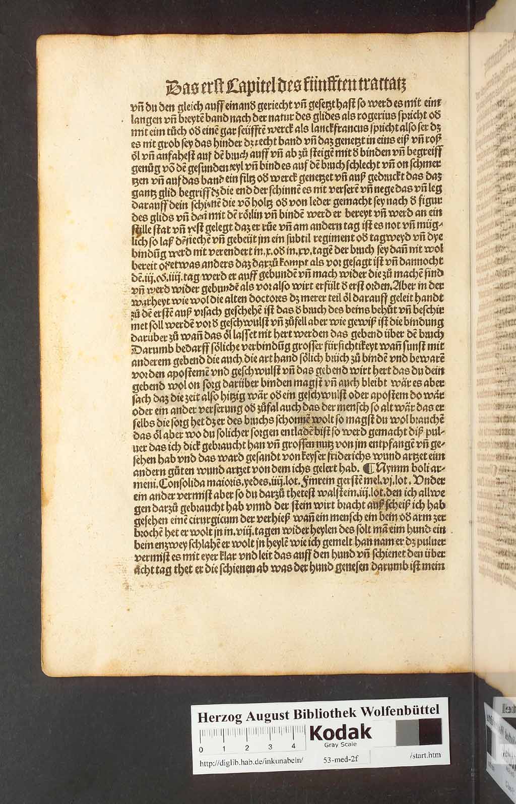 http://diglib.hab.de/inkunabeln/53-med-2f/00192.jpg