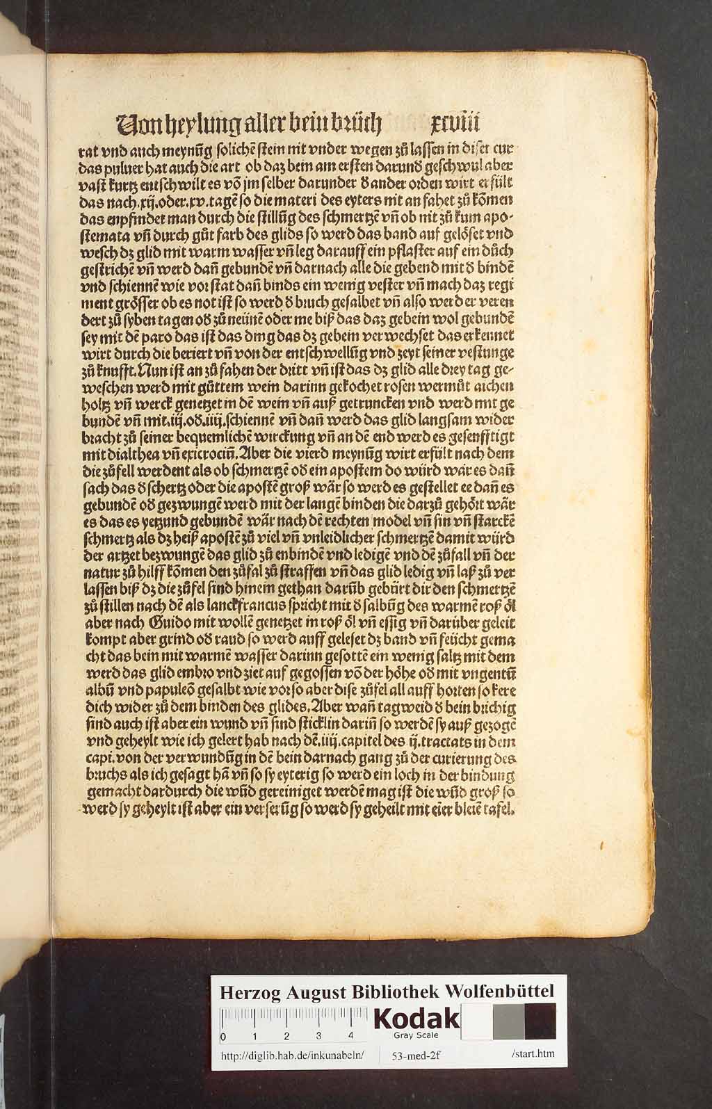 http://diglib.hab.de/inkunabeln/53-med-2f/00193.jpg