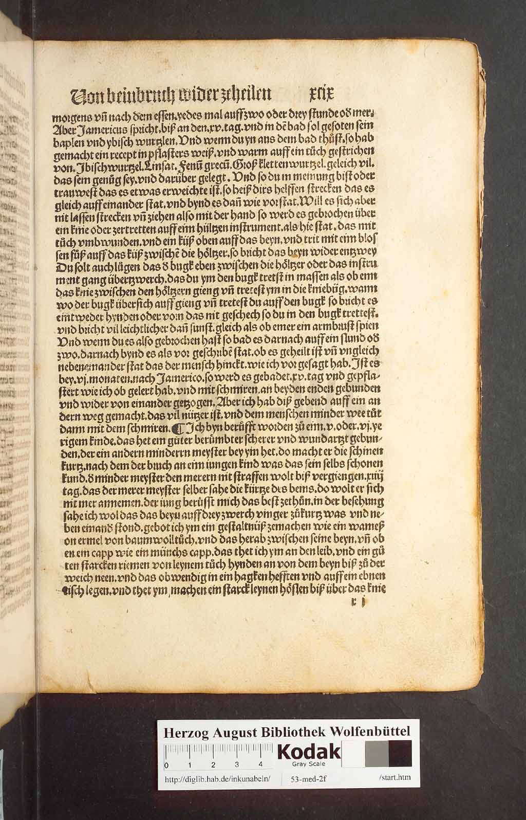 http://diglib.hab.de/inkunabeln/53-med-2f/00195.jpg