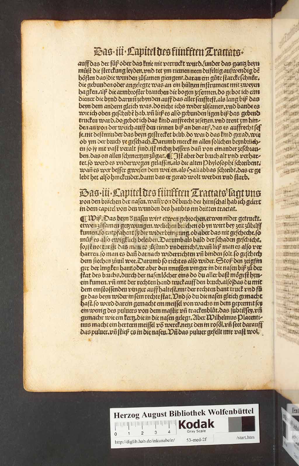 http://diglib.hab.de/inkunabeln/53-med-2f/00196.jpg