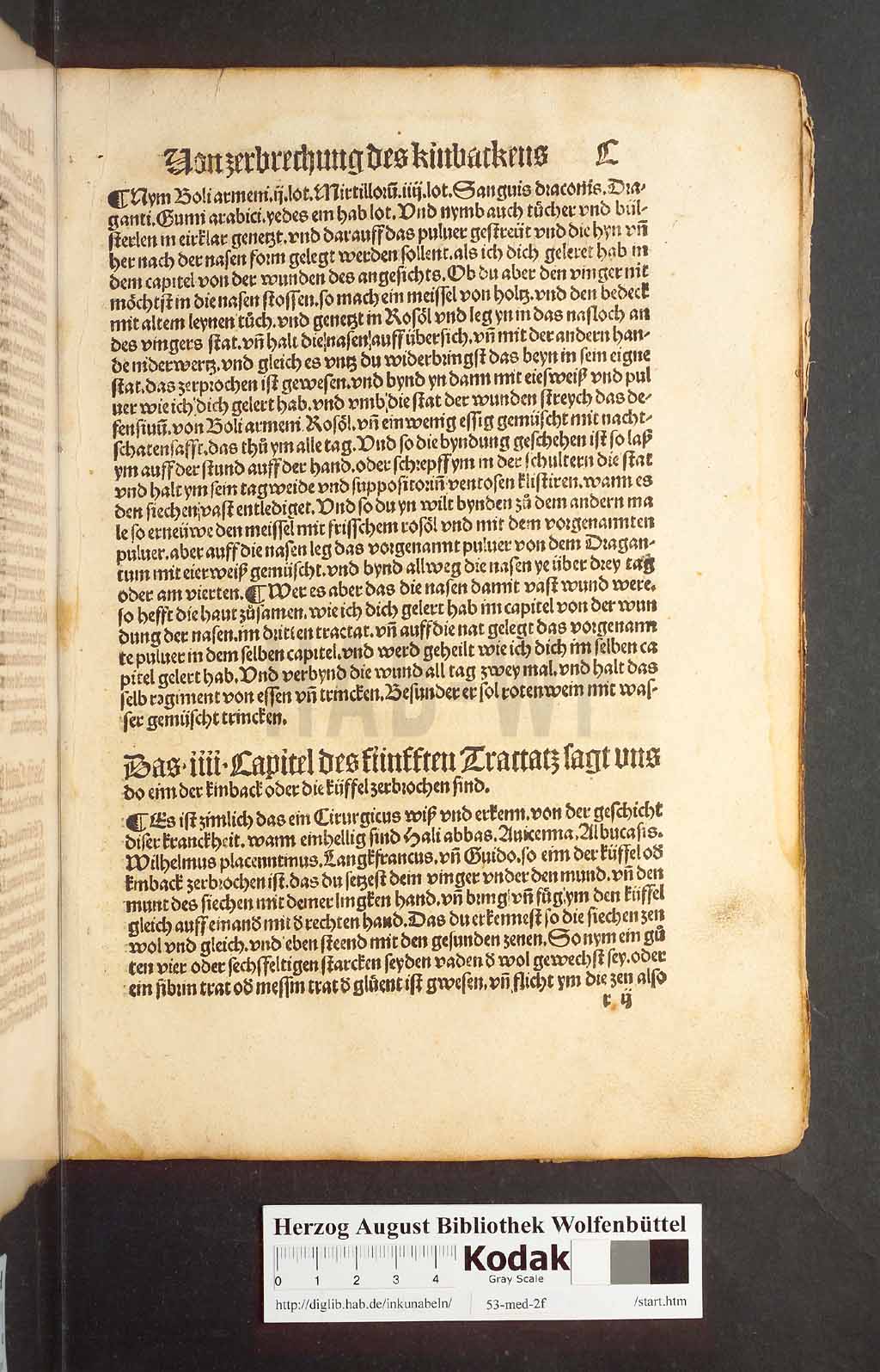 http://diglib.hab.de/inkunabeln/53-med-2f/00197.jpg