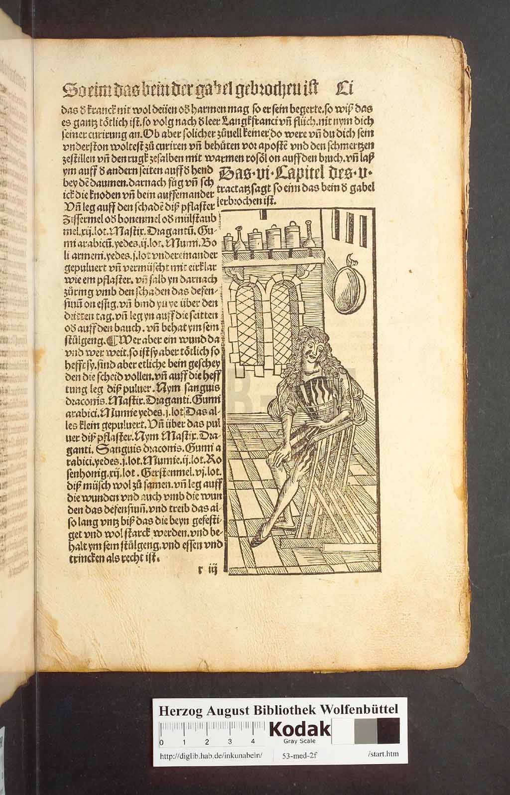 http://diglib.hab.de/inkunabeln/53-med-2f/00199.jpg