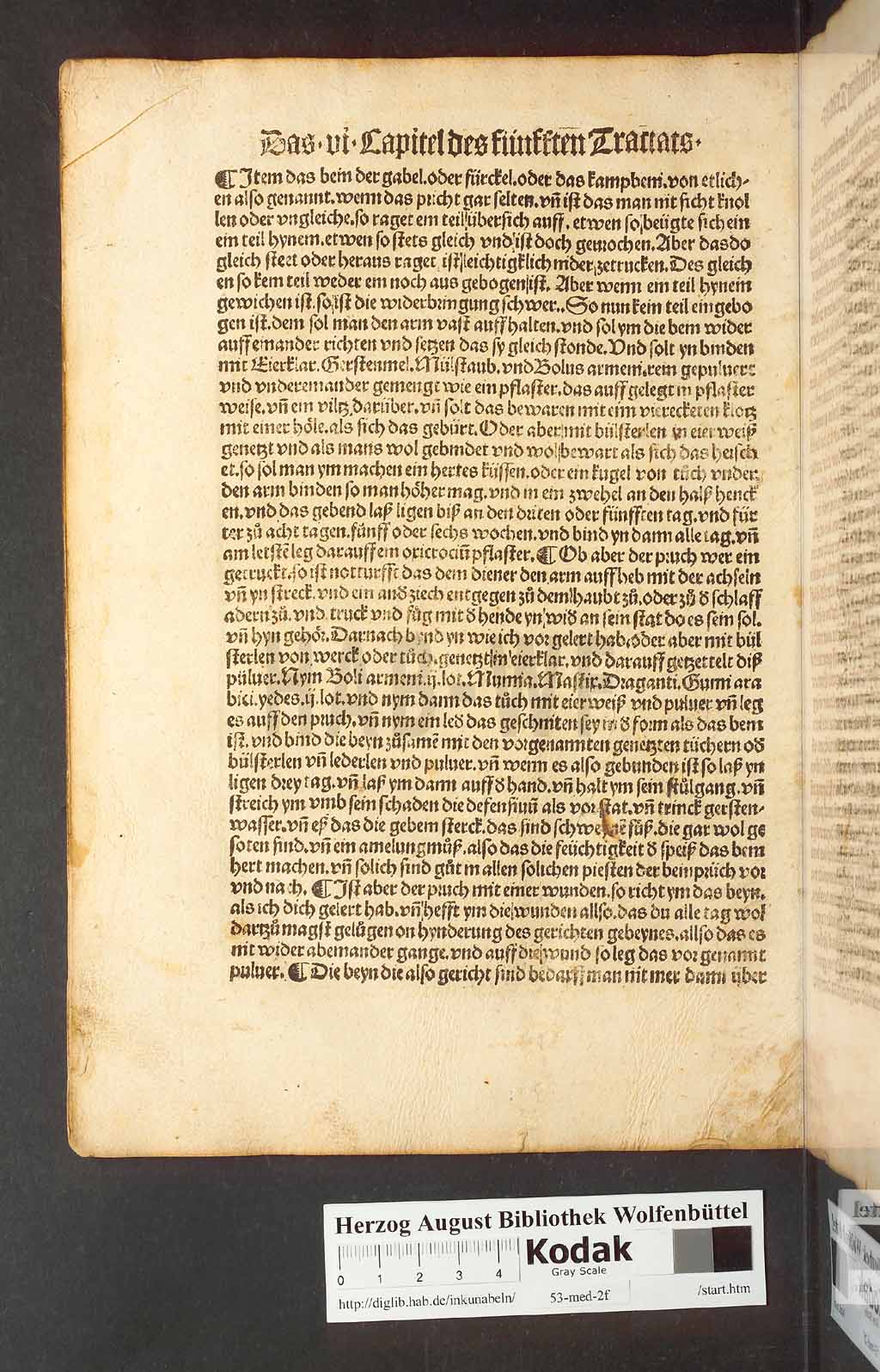 http://diglib.hab.de/inkunabeln/53-med-2f/00200.jpg