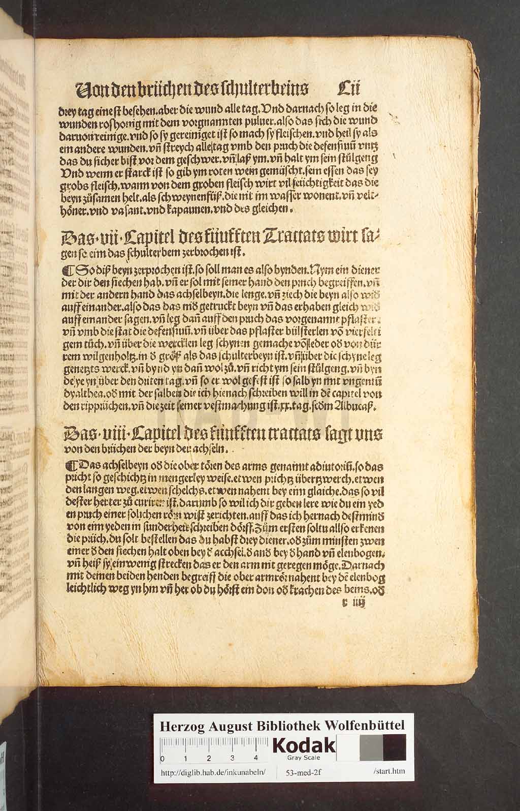 http://diglib.hab.de/inkunabeln/53-med-2f/00201.jpg