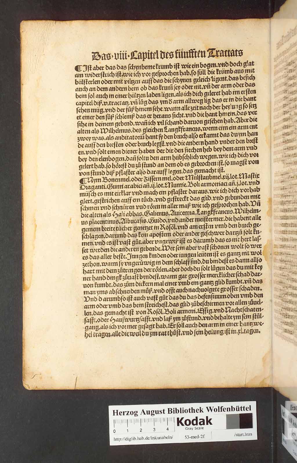http://diglib.hab.de/inkunabeln/53-med-2f/00204.jpg