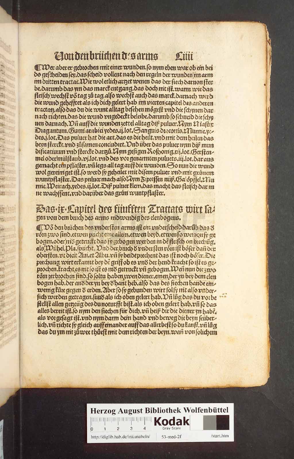 http://diglib.hab.de/inkunabeln/53-med-2f/00205.jpg