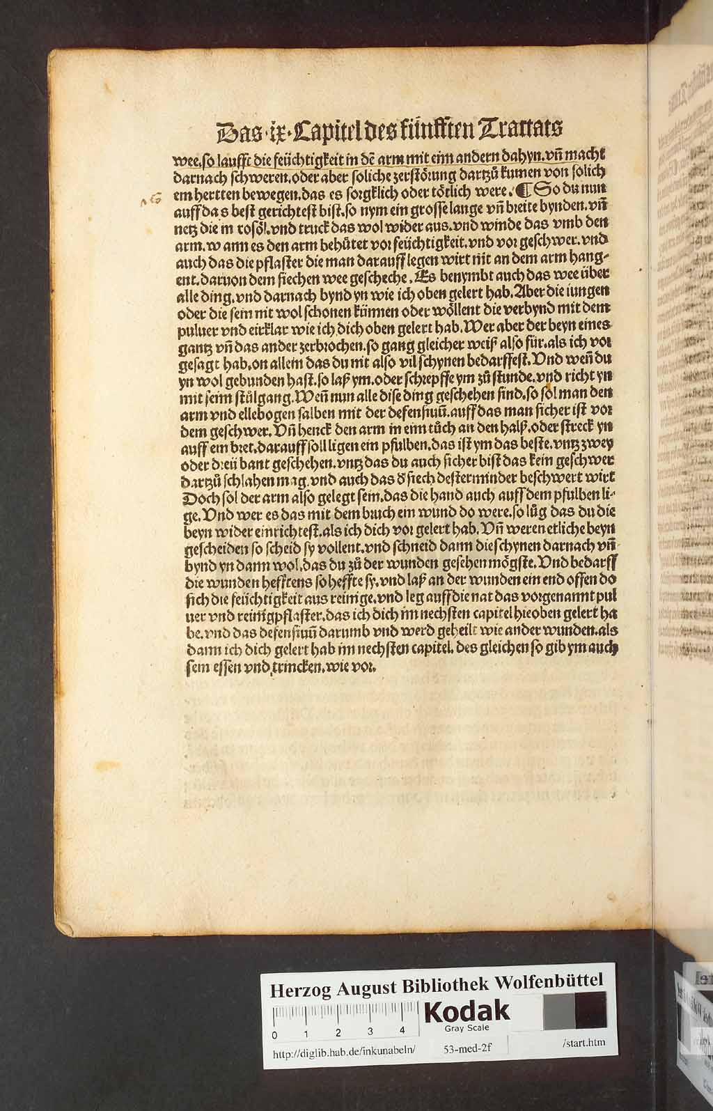 http://diglib.hab.de/inkunabeln/53-med-2f/00206.jpg