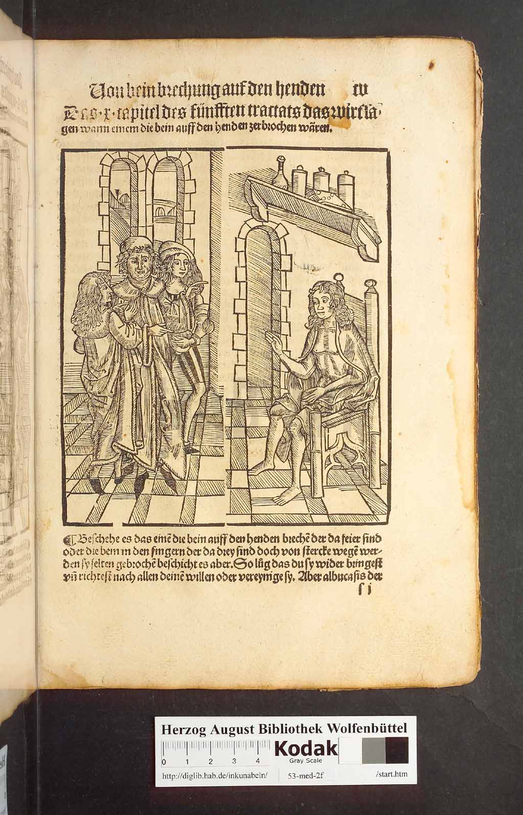 http://diglib.hab.de/inkunabeln/53-med-2f/00207.jpg