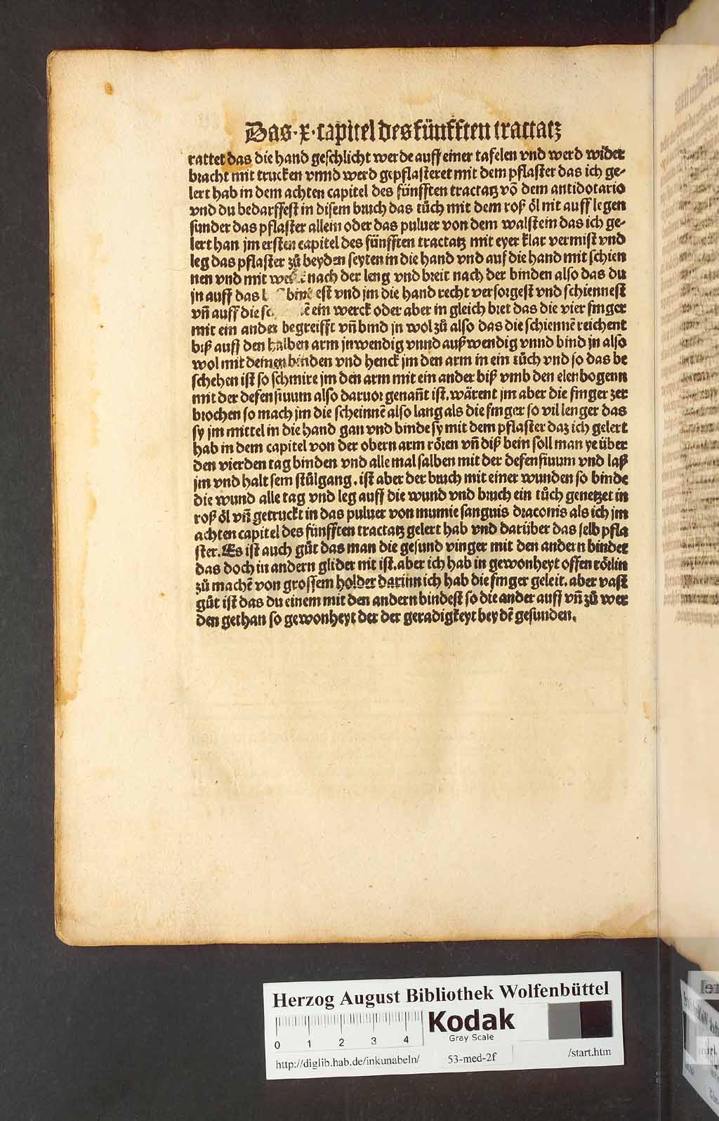 http://diglib.hab.de/inkunabeln/53-med-2f/00208.jpg