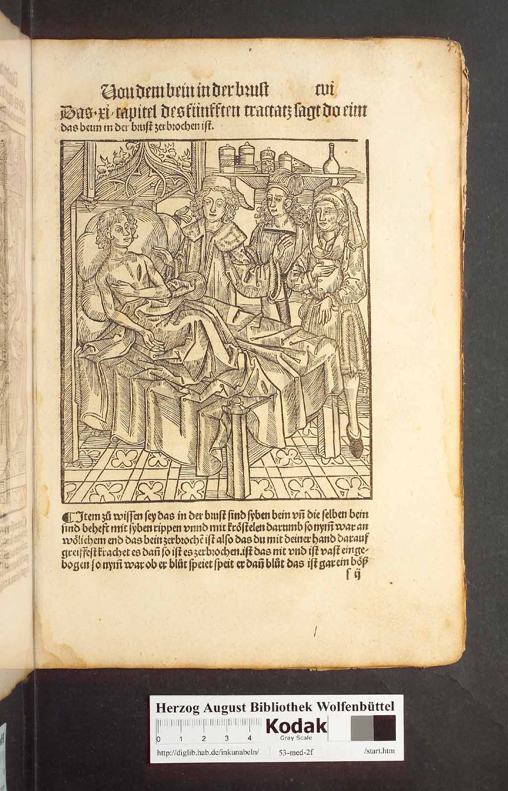 http://diglib.hab.de/inkunabeln/53-med-2f/00209.jpg