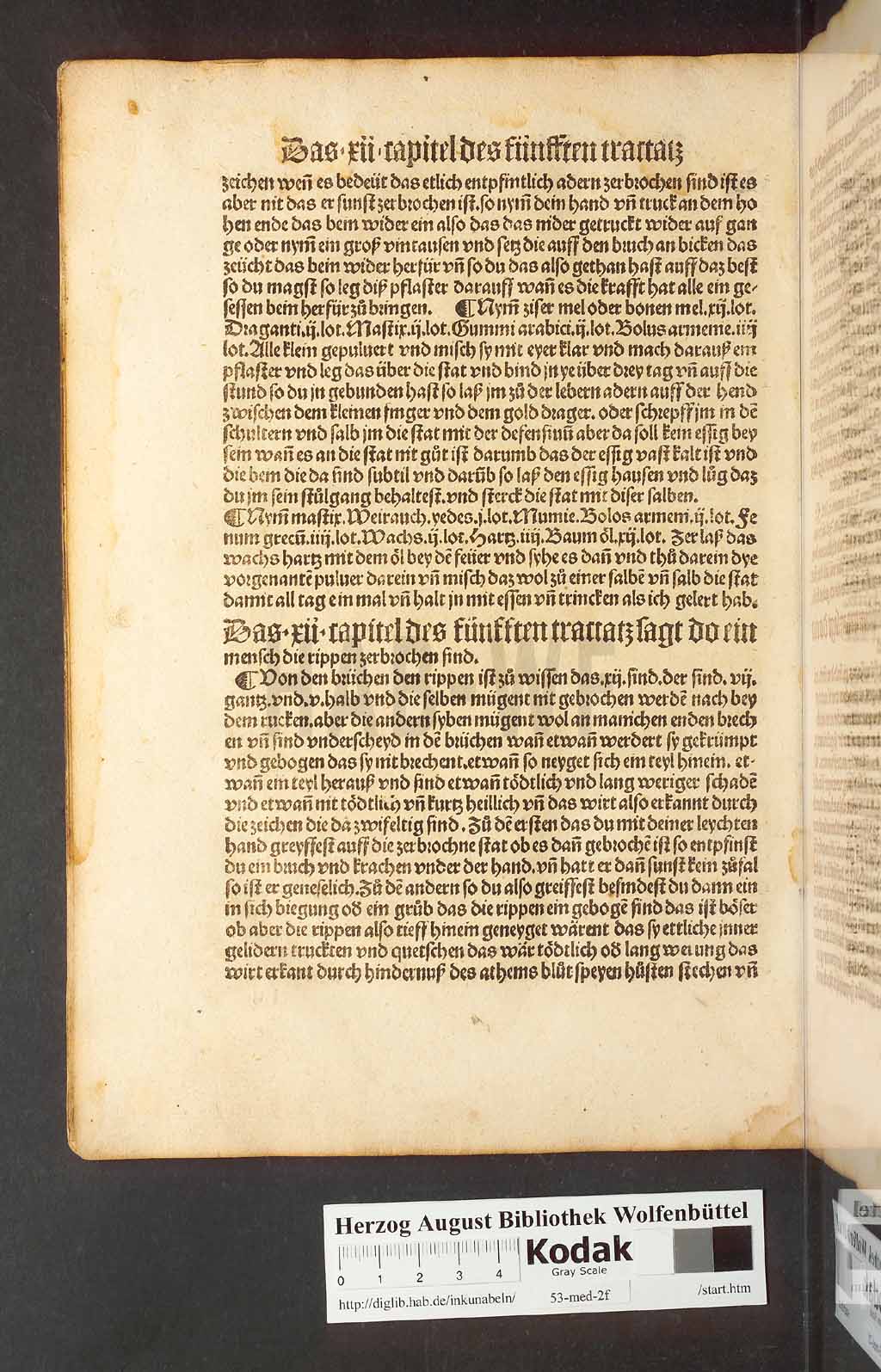 http://diglib.hab.de/inkunabeln/53-med-2f/00210.jpg