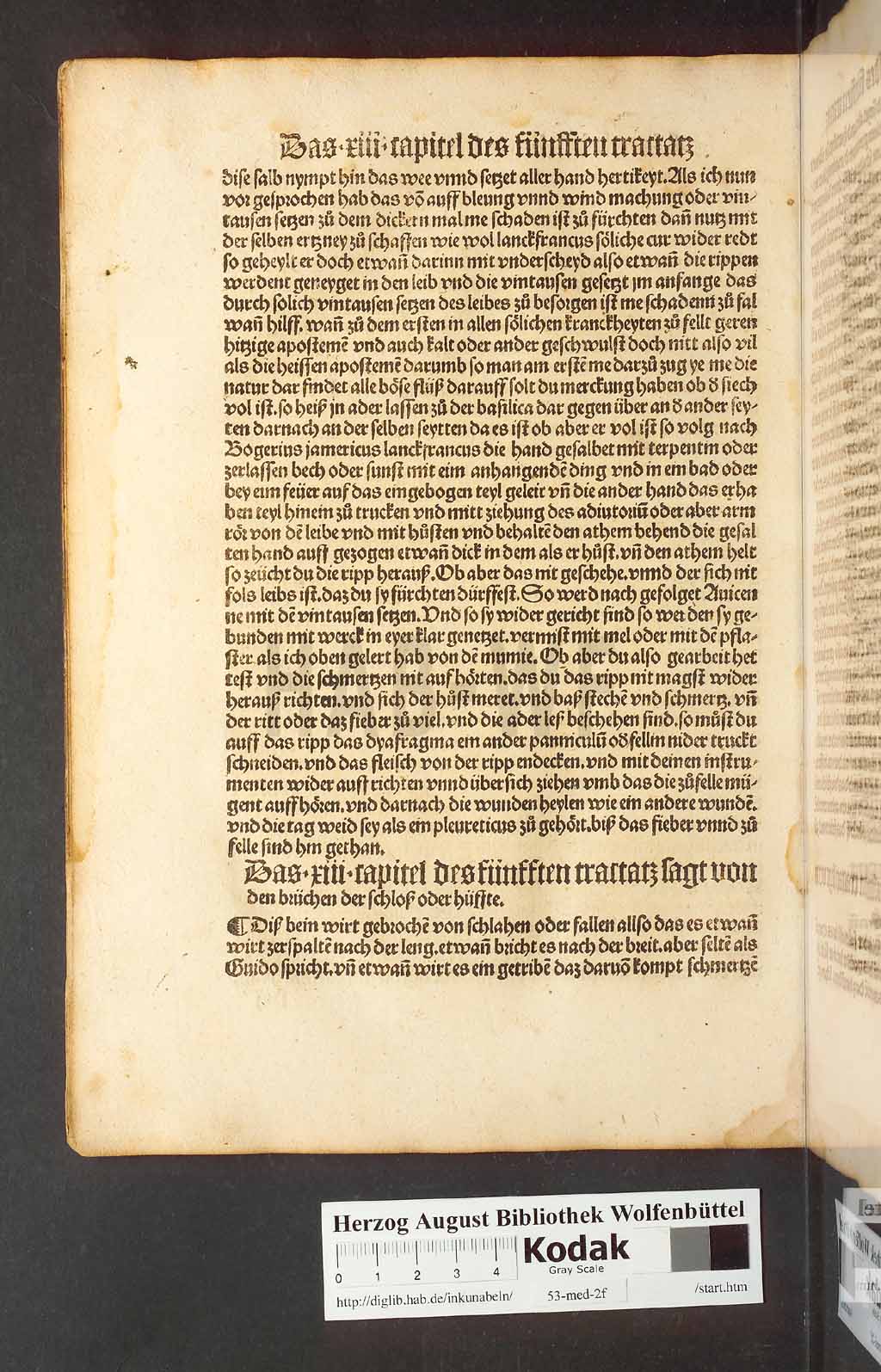 http://diglib.hab.de/inkunabeln/53-med-2f/00212.jpg