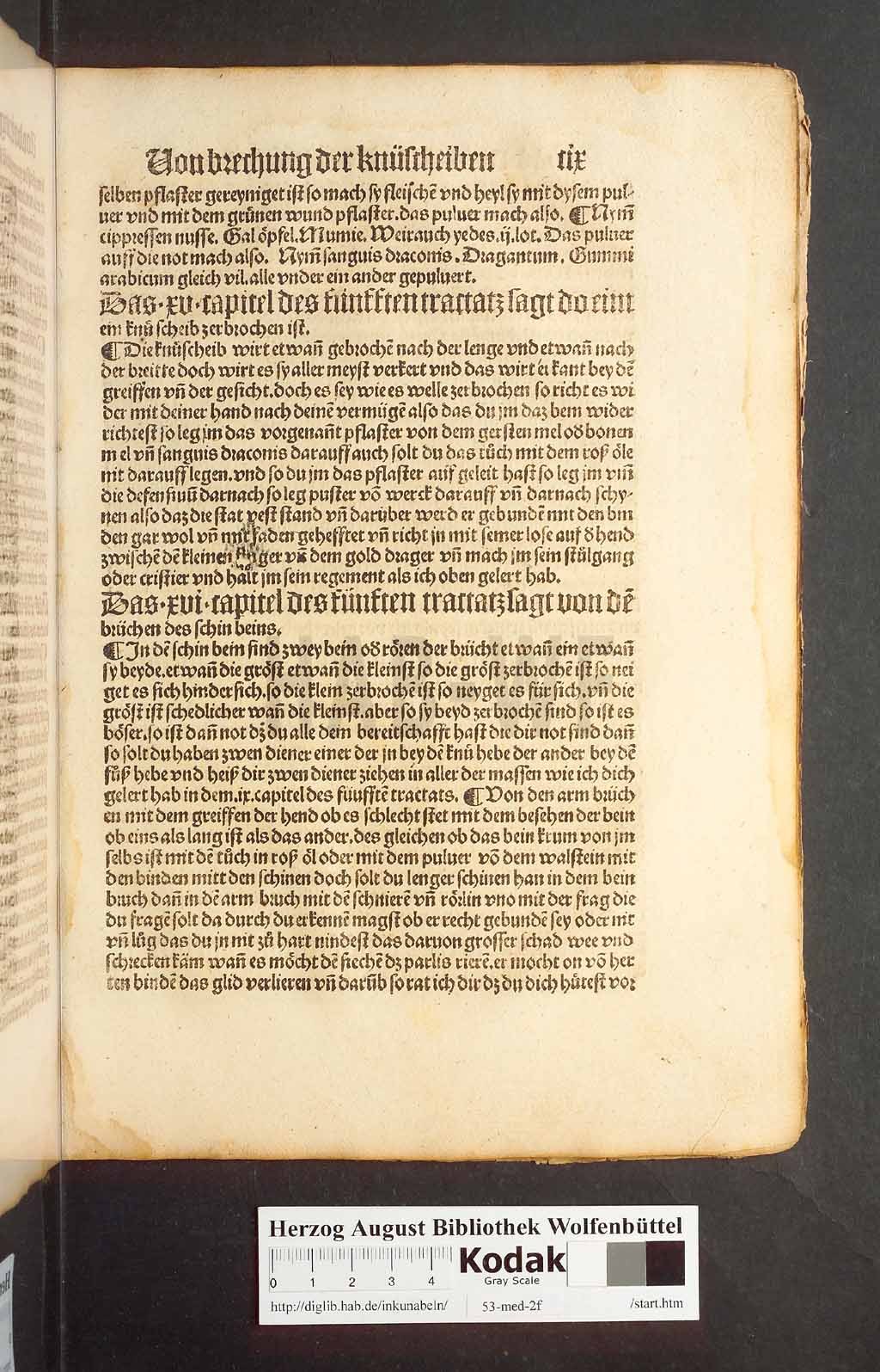 http://diglib.hab.de/inkunabeln/53-med-2f/00215.jpg