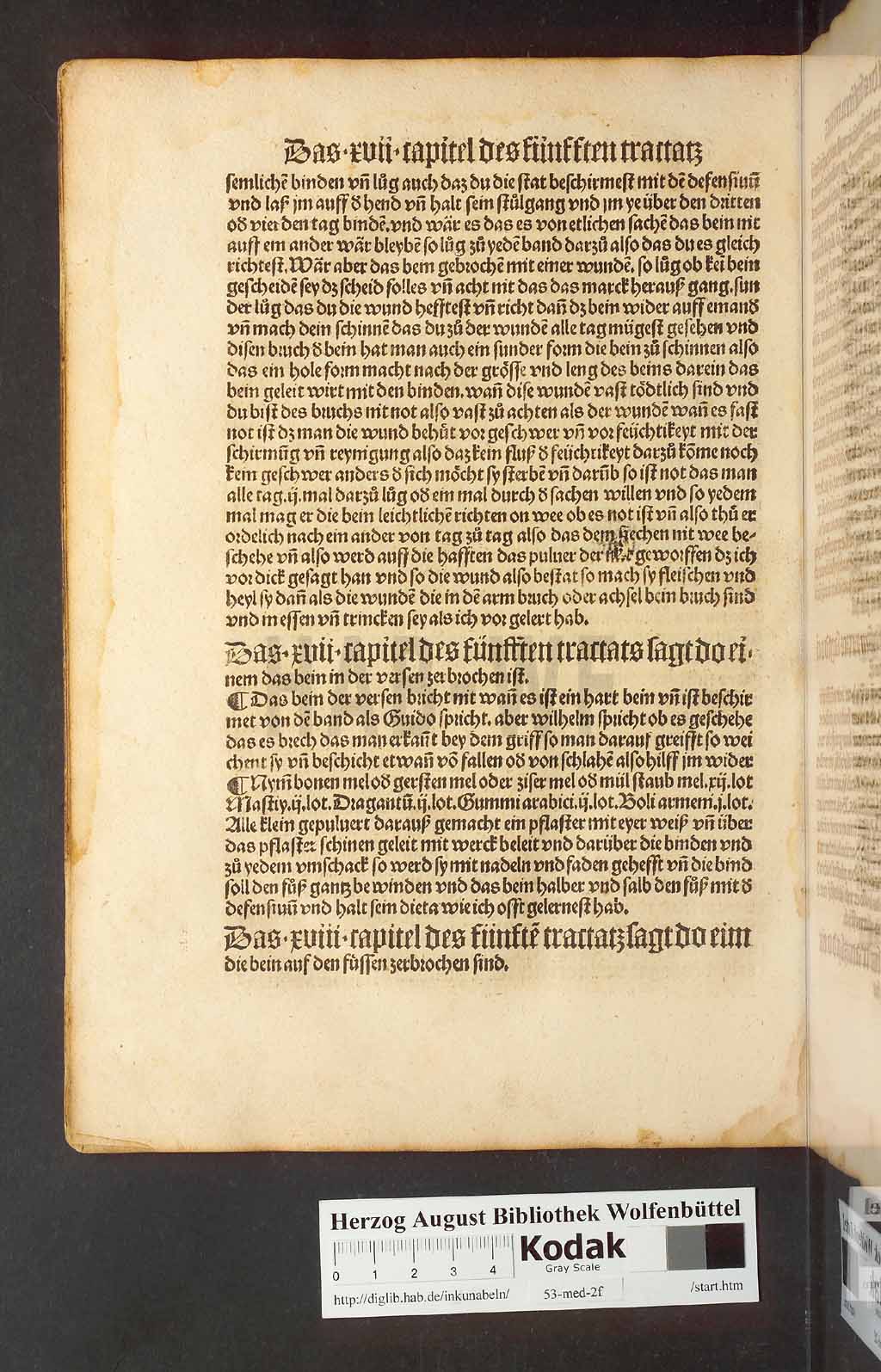 http://diglib.hab.de/inkunabeln/53-med-2f/00216.jpg