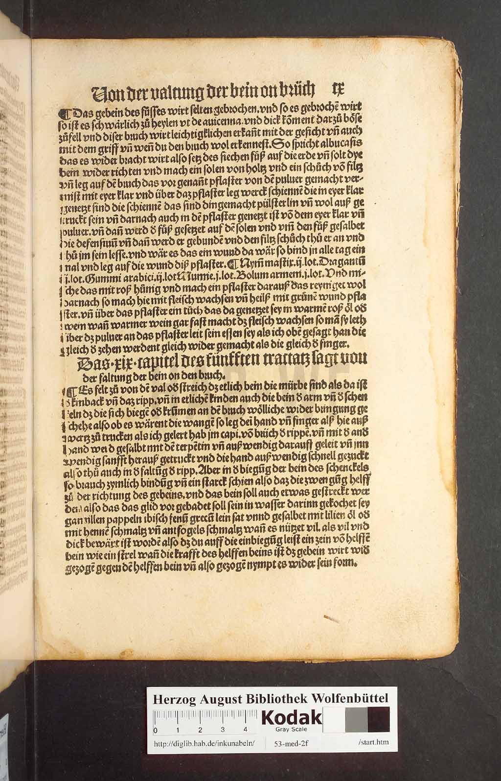 http://diglib.hab.de/inkunabeln/53-med-2f/00217.jpg