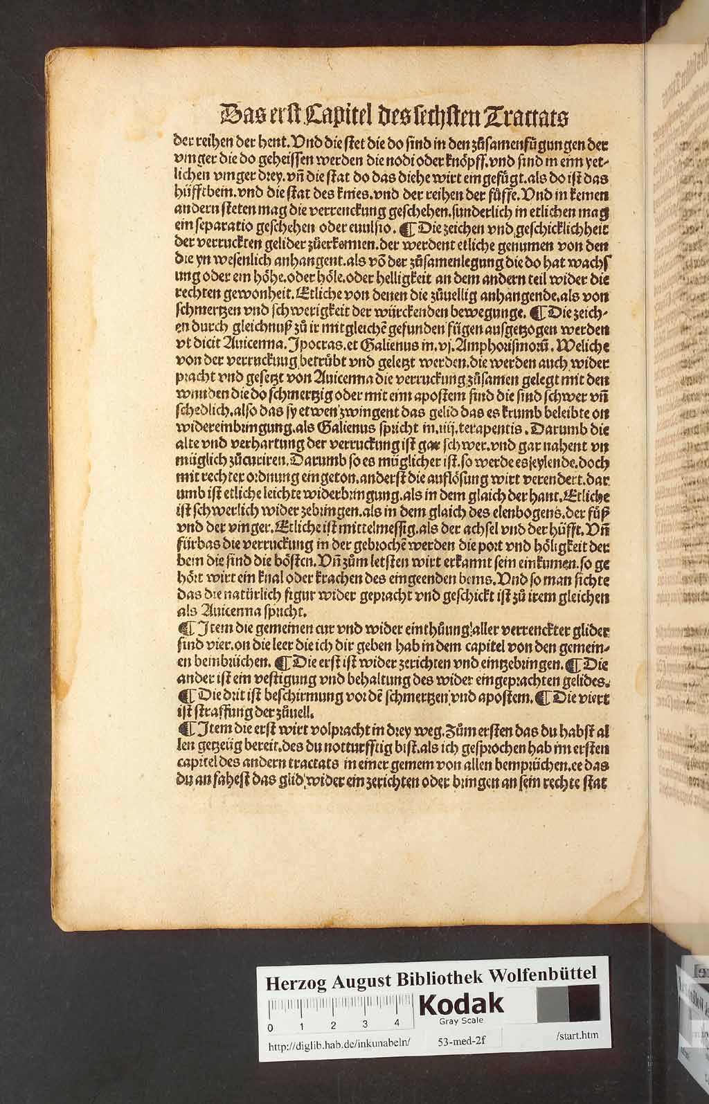 http://diglib.hab.de/inkunabeln/53-med-2f/00220.jpg