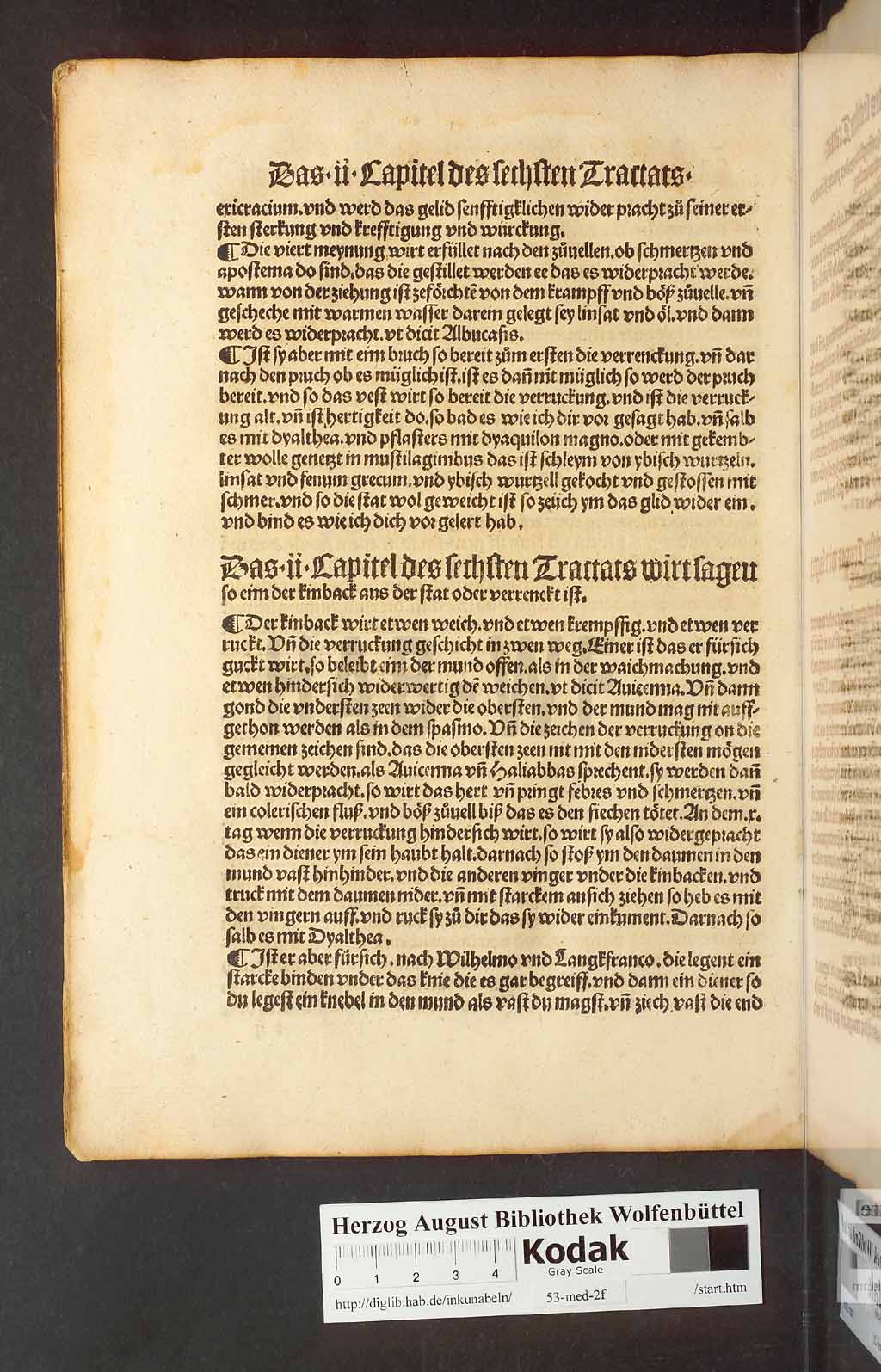 http://diglib.hab.de/inkunabeln/53-med-2f/00222.jpg