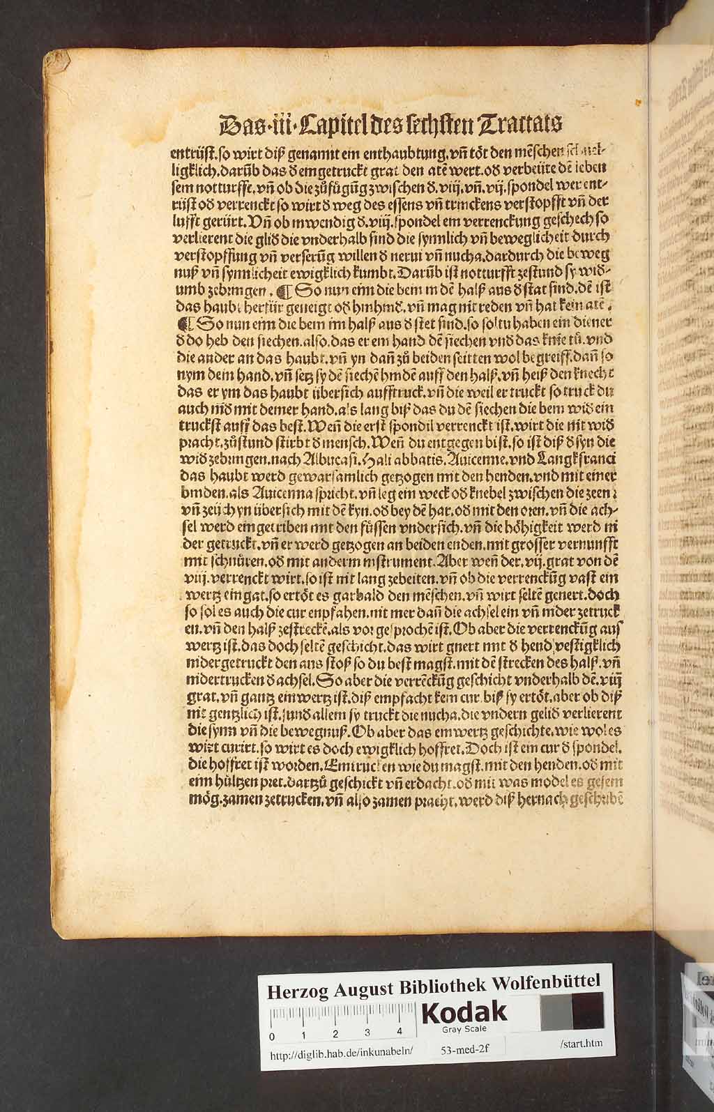 http://diglib.hab.de/inkunabeln/53-med-2f/00224.jpg