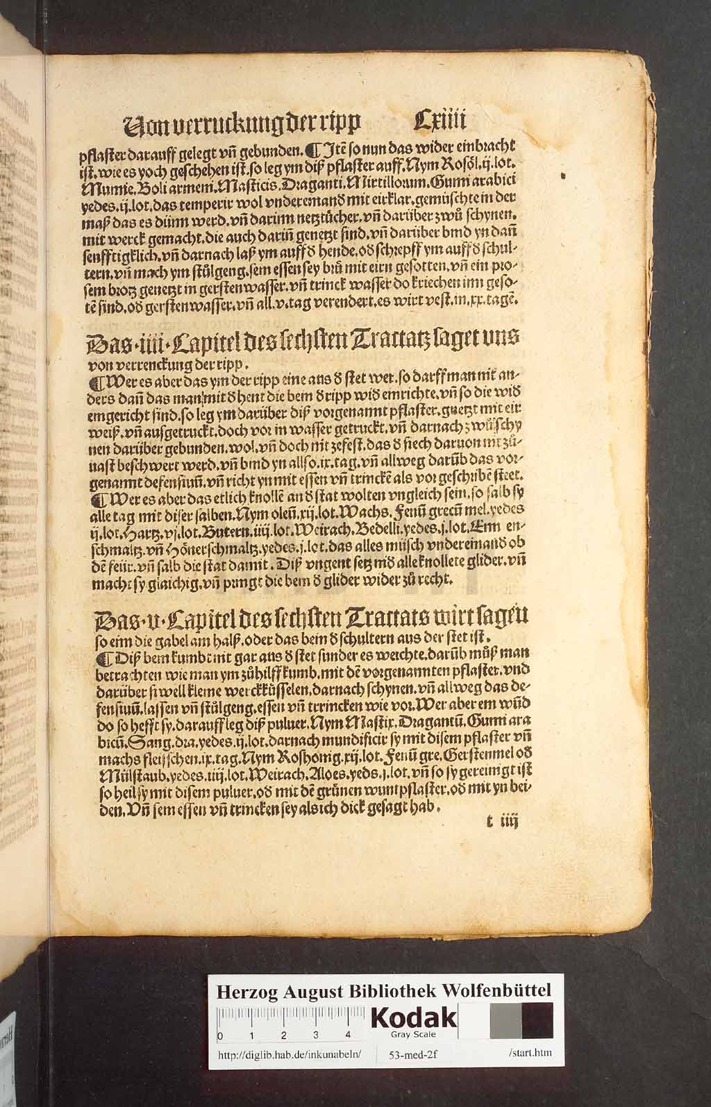 http://diglib.hab.de/inkunabeln/53-med-2f/00225.jpg