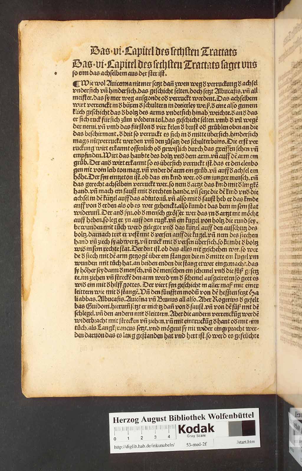 http://diglib.hab.de/inkunabeln/53-med-2f/00226.jpg