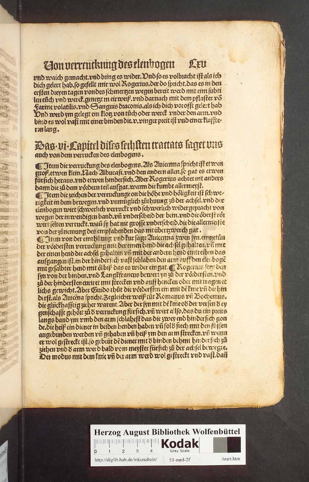 http://diglib.hab.de/inkunabeln/53-med-2f/00227.jpg