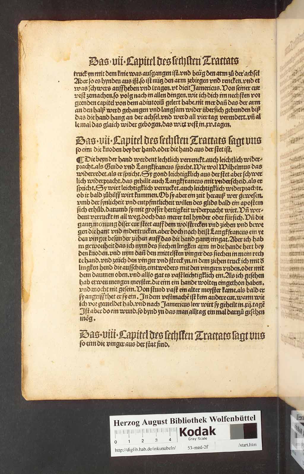http://diglib.hab.de/inkunabeln/53-med-2f/00228.jpg
