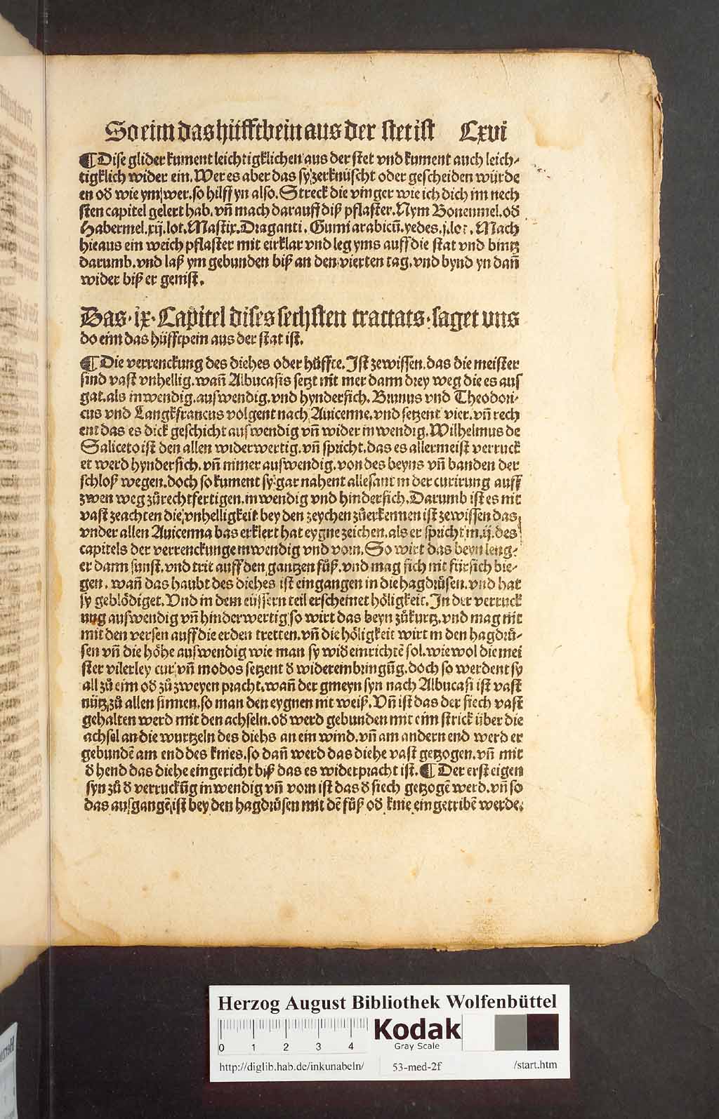 http://diglib.hab.de/inkunabeln/53-med-2f/00229.jpg
