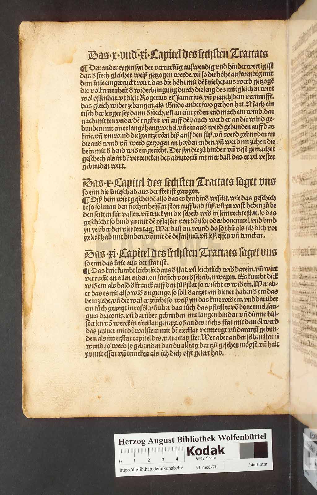http://diglib.hab.de/inkunabeln/53-med-2f/00230.jpg