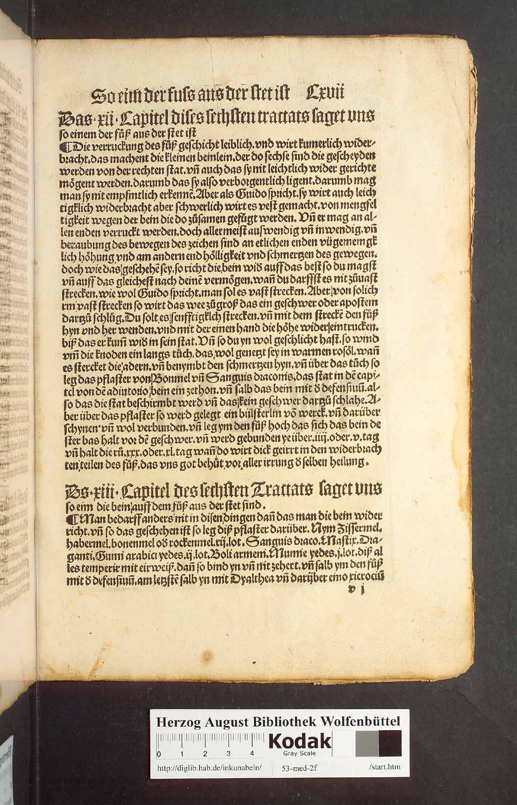 http://diglib.hab.de/inkunabeln/53-med-2f/00231.jpg