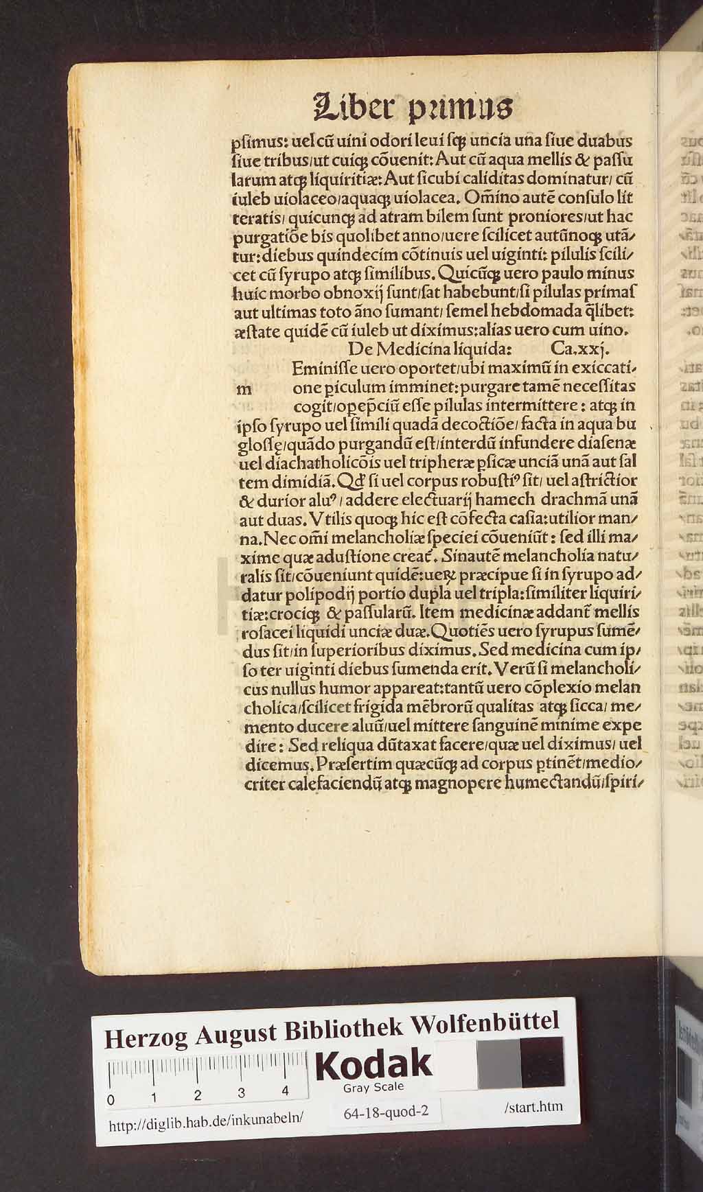 http://diglib.hab.de/inkunabeln/64-18-quod-2/00032.jpg