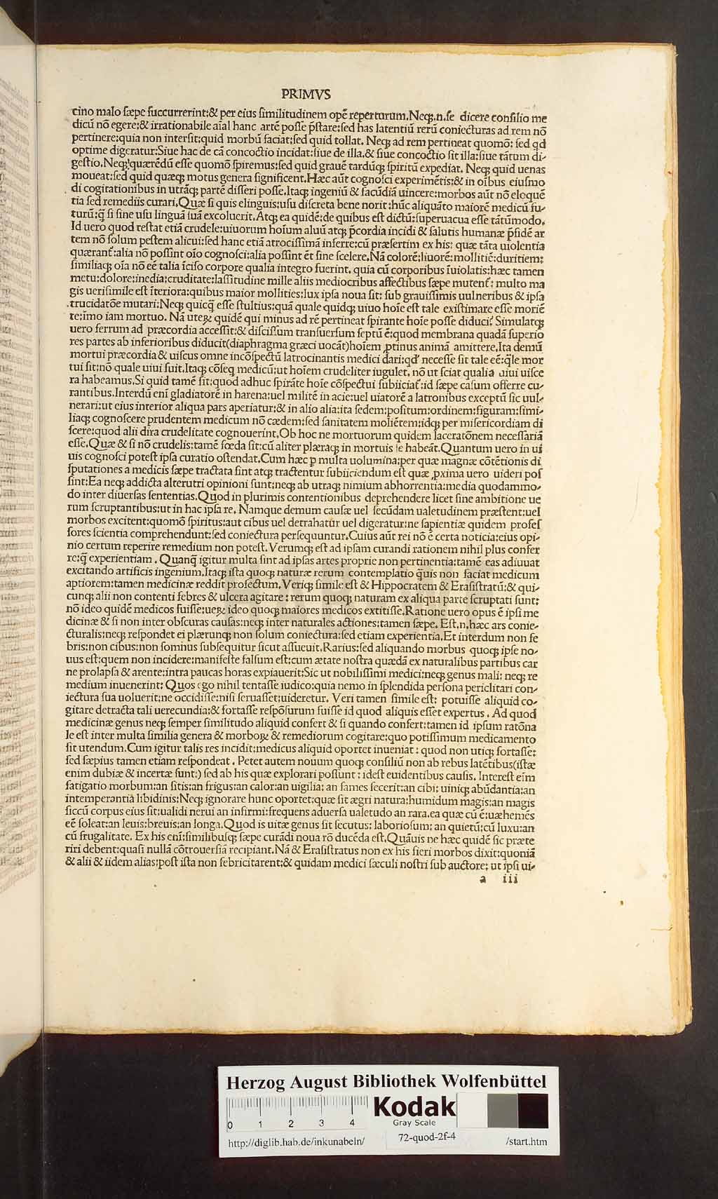 http://diglib.hab.de/inkunabeln/72-quod-2f-4/00005.jpg