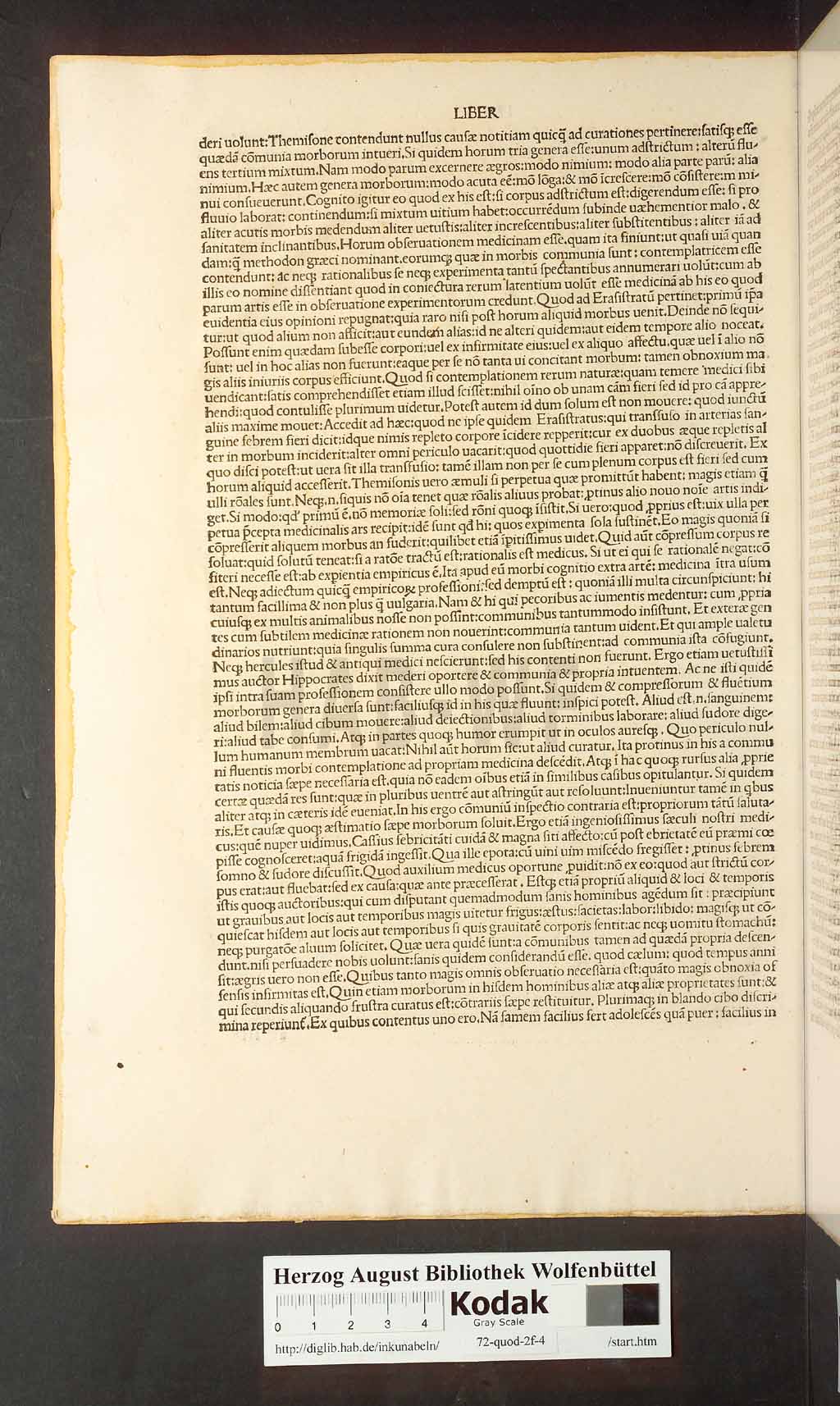 http://diglib.hab.de/inkunabeln/72-quod-2f-4/00006.jpg