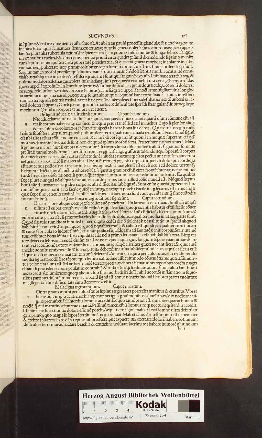 http://diglib.hab.de/inkunabeln/72-quod-2f-4/00013.jpg