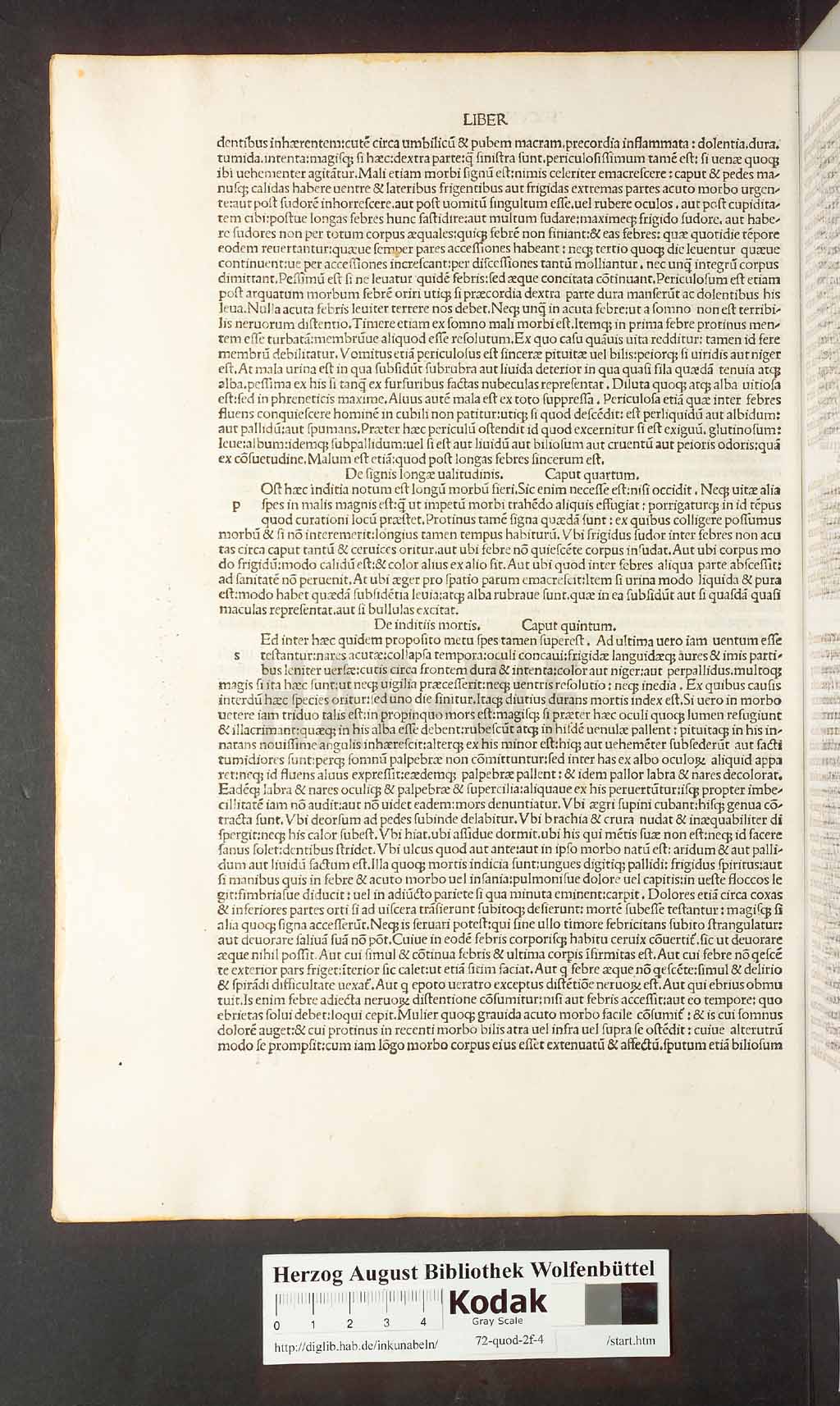 http://diglib.hab.de/inkunabeln/72-quod-2f-4/00014.jpg