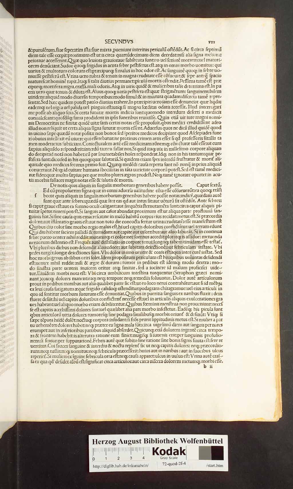 http://diglib.hab.de/inkunabeln/72-quod-2f-4/00015.jpg